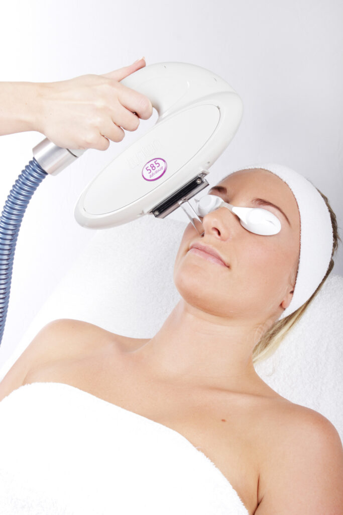 Client receiving IPL skin rejuvenation treatment