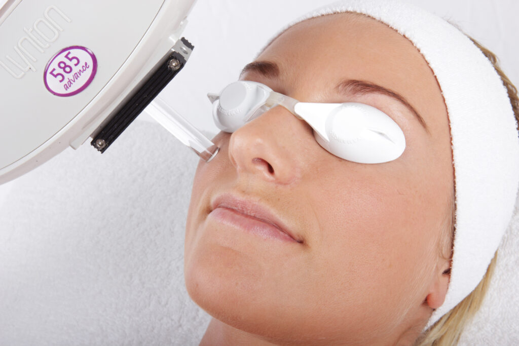 Client receiving IPL skin rejuvenation treatment