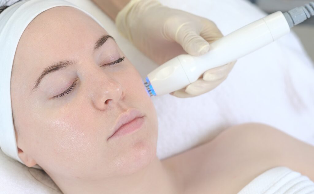 Client having rf skin tightening on face