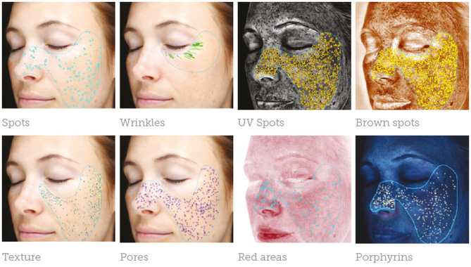 Skin changes seen in Opatra digital skin analyser