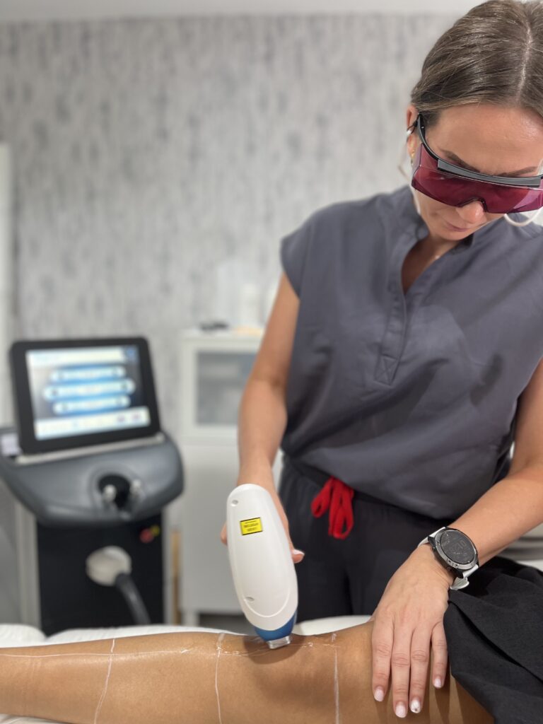 Aesthetician holding laser head and doing hair removal on client’s legs