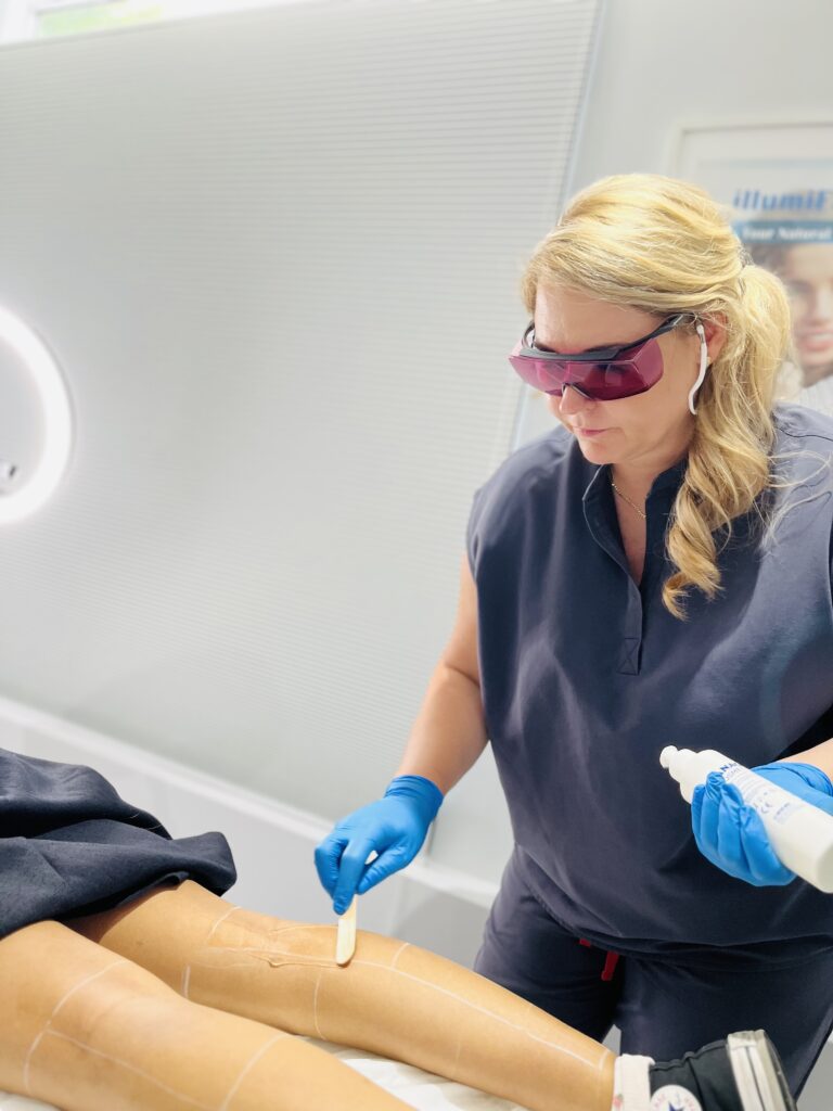 Aesthetician applying gel before laser hair removal