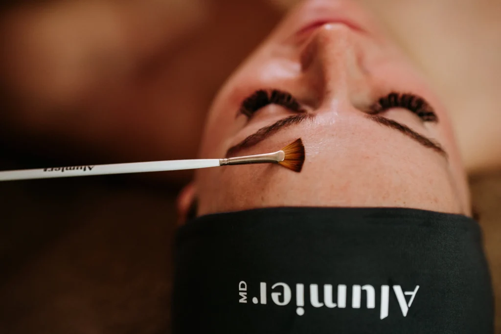 Client during chemical skin peel. Peel application with a brush