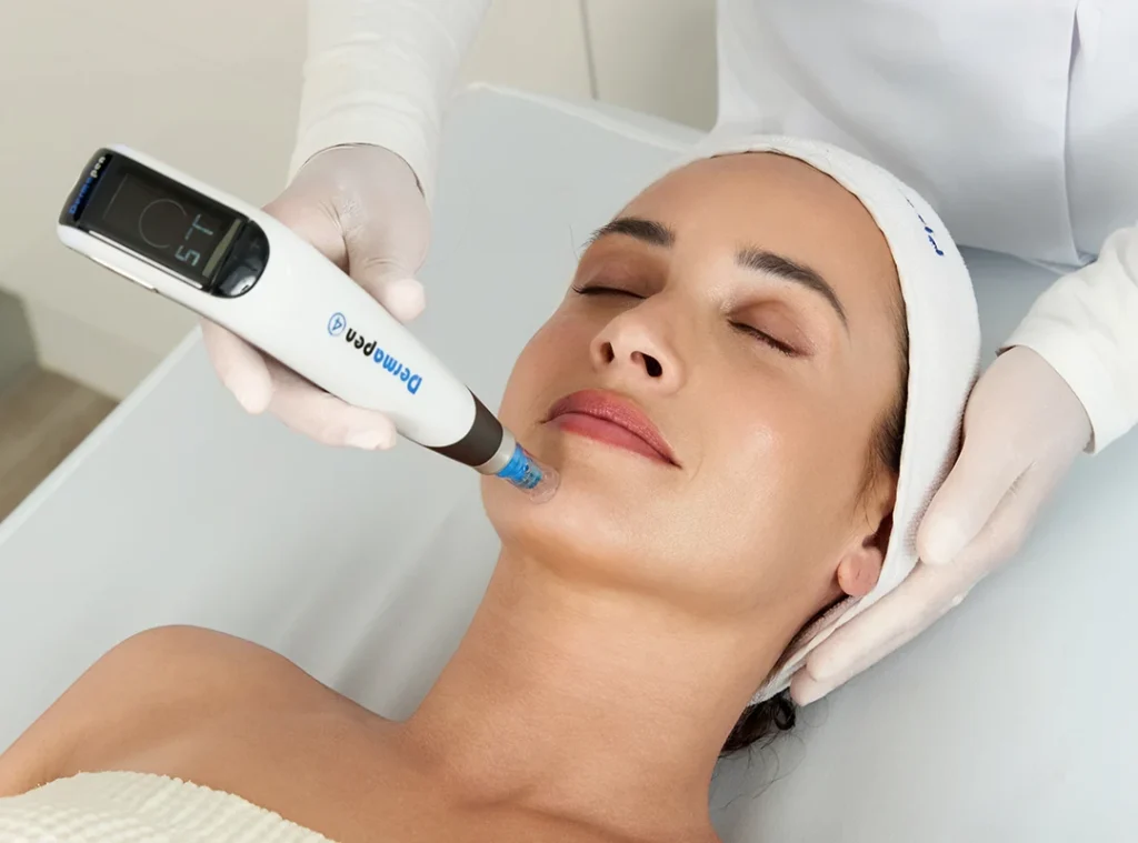Woman receiving Dermapen 4 microneedling on the face